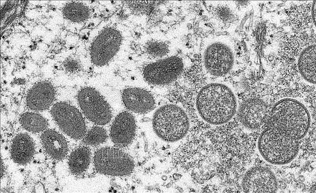 Image of monkeypox virus under an electron microscope. Photo: AFP/VNA Image of monkeypox virus under an electron microscope. Photo: AFP/VNA