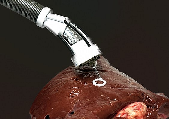 3D Printing the Human Body: A Medical Marvel Made Possible by Overseas Vietnamese