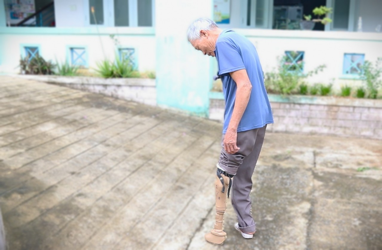 MCNV hỗ trợ làm chân tay giả, giày nẹp chỉnh hình cho người khuyết tật MCNV hỗ trợ làm chân tay giả, giày nẹp chỉnh hình cho người khuyết tật