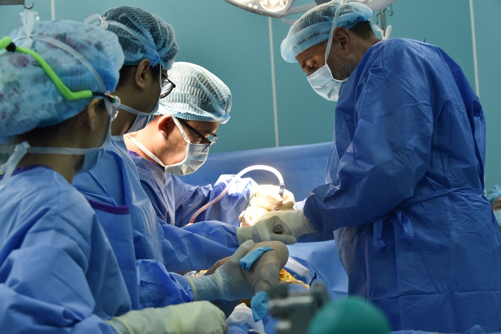 Nhiều bệnh nhân nghèo tại thành phố Hồ Chí Minh được phẫu thuật miễn phí Nhiều bệnh nhân nghèo tại thành phố Hồ Chí Minh được phẫu thuật miễn phí