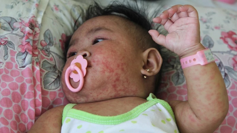 Gần 15 triệu trẻ em không được tiêm chủng vaccine thiết yếu 3 Gần 15 triệu trẻ em không được tiêm chủng vaccine thiết yếu 3