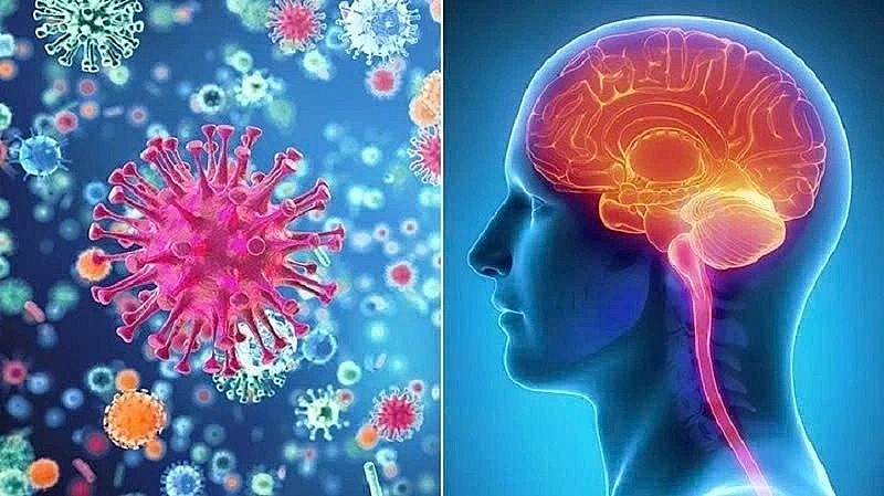 Doctor say meningococcal disease can be life-threatening and progress rapidly., and without timely treatment, the fatality rate can reach up to 50% within 24 to 48 hours. Doctor say meningococcal disease can be life-threatening and progress rapidly., and without timely treatment, the fatality rate can reach up to 50% within 24 to 48 hours.