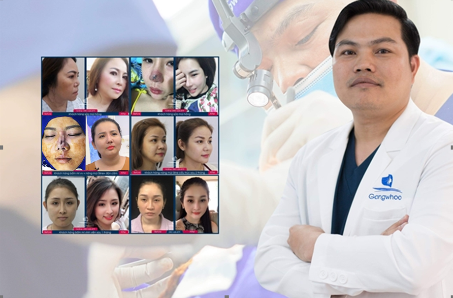Bác sĩ Phùng Mạnh Cường – Chuyên gia sửa mũi hỏng ... bac si phung manh cuong chuyen gia sua mui hong