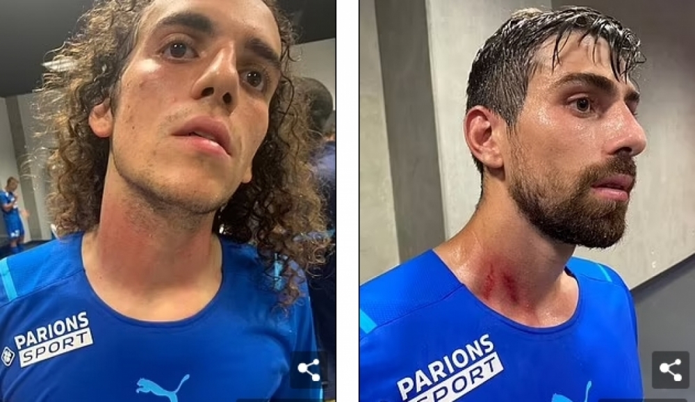 Các cổ động viên quá khích của Nice khiến Matteo Guendouzi và Luan Peres bị thương. Các cổ động viên quá khích của Nice khiến Matteo Guendouzi và Luan Peres bị thương.