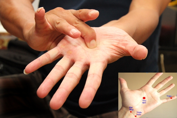 Hướng dẫn cách bấm huyệt chữa chứng thiếu máu não, nguy cơ đột quỵ chi tiết nhất huong dan cach bam huyet chua chung thieu mau nao nguy co dot quy chi tiet nhat