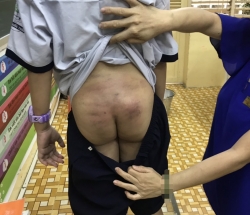 me ke khai giet con chong phi tang xac trong vuon mia la do co nguoi xui khien