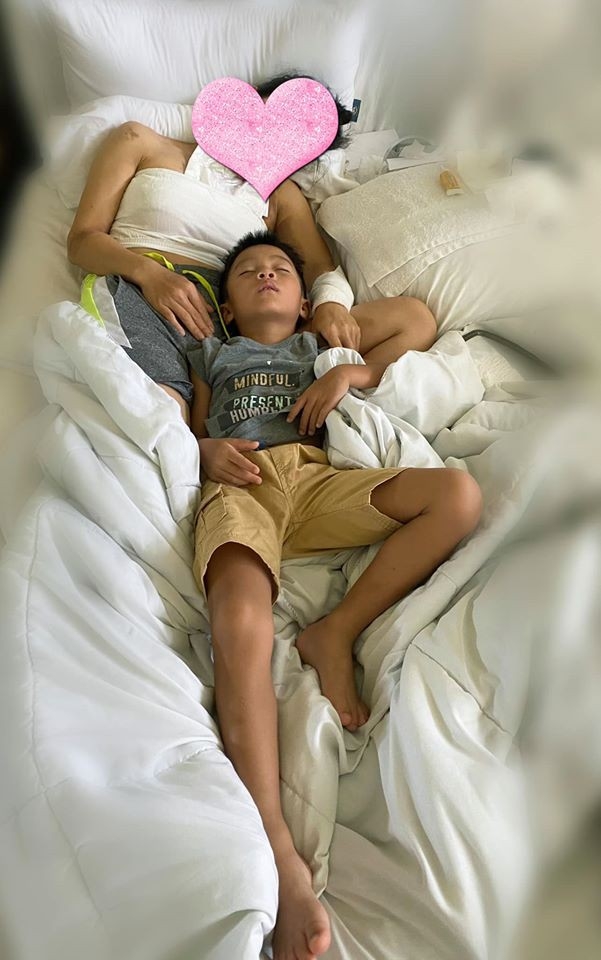 hong ngoc thay da sau khi bi bong vi no noi xong hoi