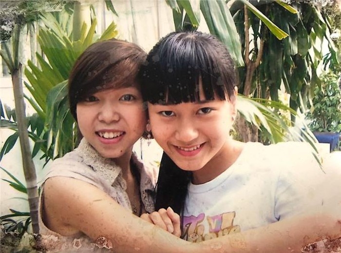 Tin tức giải trí sao Việt hôm nay (23/5): Hồng Ngọc lộ gương mặt biến dạng vì bỏng nặng tin tuc giai tri sao viet hom nay 235 hong ngoc lo guong mat bien dang vi bong nang