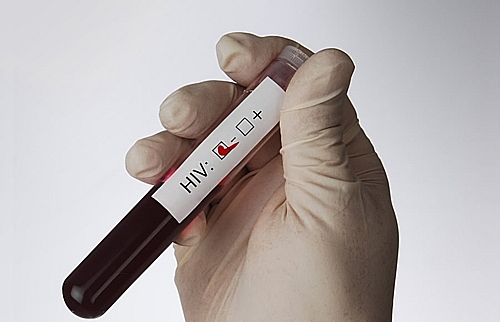 Cấy ghép tế bào gốc - phương pháp cứu người bệnh khỏi virus HIV cay ghep te bao goc phuong phap cuu nguoi benh khoi virus hiv