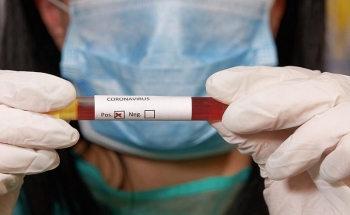 Novel coronavirus: what do we know so far?