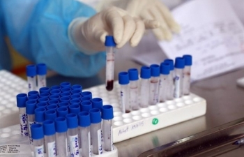 a landmark partnership announced for development of covid 19 vaccine in the uk