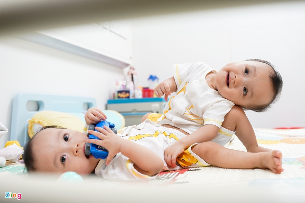 undefined Truc Nhi and Dieu Nhi before the surgery