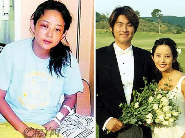 my nhan bi kich nhat han quoc bi pha mo loat nguoi than di theo