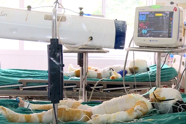 Vụ cô giáo đốt cồn dạy phòng chống cháy nổ: 3 trẻ đã thoát cơn nguy kịch vu co giao dot con day phong chong chay no 3 tre da thoat con nguy kich