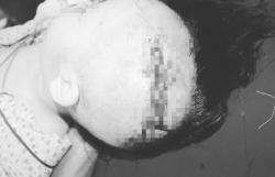 chu quan nghi no khong can dau be trai 7 tuoi bi cho can khau 70 mui