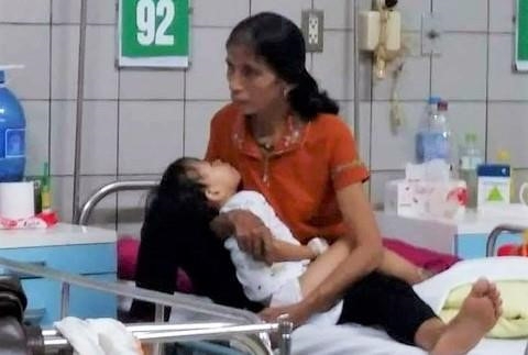 Hà Tĩnh: Bé gái 2 tuổi hoại tử chân vì bị rắn hổ mang cắn ha tinh be gai 2 tuoi hoai tu chan vi bi ran ho mang can