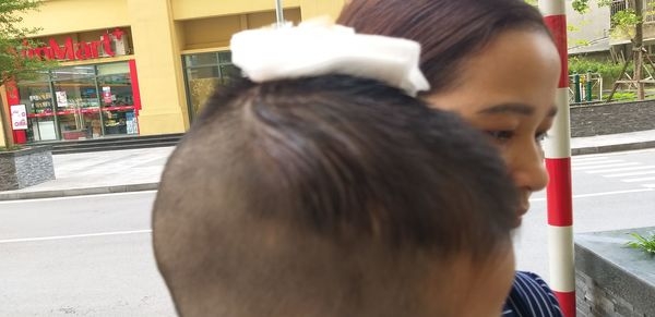Bị chổi lau nhà rơi từ tầng 17 trúng đầu, bé trai 16 tháng tuổi nhập viện khẩn cấp bi choi lau nha roi tu tang 17 trung dau be trai 16 thang tuoi nhap vien khan cap