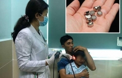 den pin doi dau phat no be 9 tuoi bi dap nat toan bo ban tay