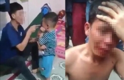 vu be trai 8 tuoi nghi bi bo bao hanh do nuoc soi len nguoi o long an bong do pha ca phe