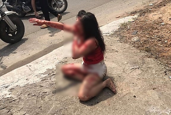 nu nhan vien quan ca phe bi rach nhieu nhat dao vao mat o binh duong