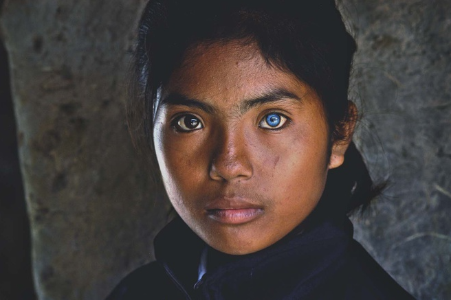 Vietnamese Girl with Different-Colored Eyes Stuns the World Vietnamese Girl with Different-Colored Eyes Stuns the World