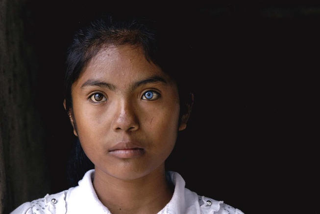 Vietnamese Girl with Different-Colored Eyes Stuns the World Vietnamese Girl with Different-Colored Eyes Stuns the World