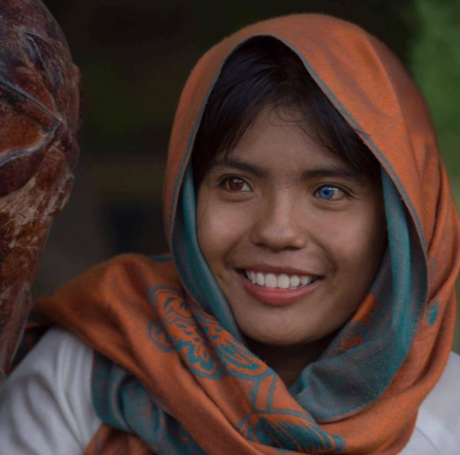 Vietnamese Girl with Different-Colored Eyes Stuns the World Vietnamese Girl with Different-Colored Eyes Stuns the World