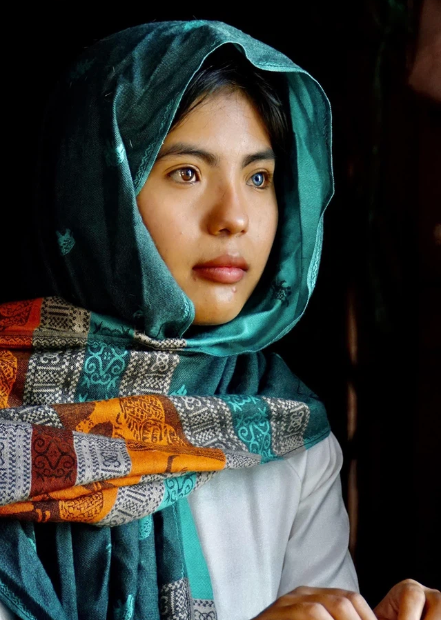 Vietnamese Girl with Different-Colored Eyes Stuns the World Vietnamese Girl with Different-Colored Eyes Stuns the World