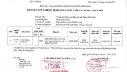 lo ngai virus corona israel cam nguoi tu nhat ban han quoc nhap canh