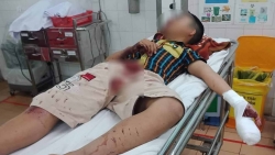 hue thanh nien bi manh phao tu che ban vao dau dem giao thua