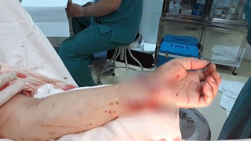Đi ăn tất niên nhà hàng xóm, người phụ nữ bị chém lìa tay di an tat nien nha hang xom nguoi phu nu bi chem lia tay