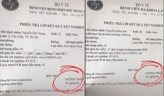 5 hoc sinh bi trieu tap vi lam gia phieu xet nghiem duong tinh virus corona