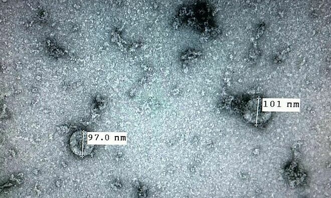 Tin vui: Việt Nam lần đầu nuôi cấy, phân lập thành công virus corona mới tin vui viet nam lan dau tien nuoi cay thanh cong virus corona moi