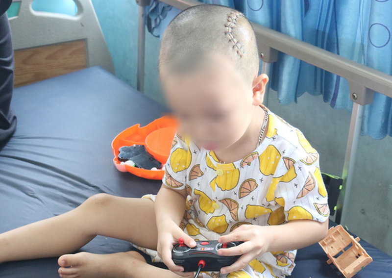 Bé trai bị lõm sọ vì ngã từ gác cao 3m xuống đất be trai bi lom so vi nga tu gac cao 3m xuong dat