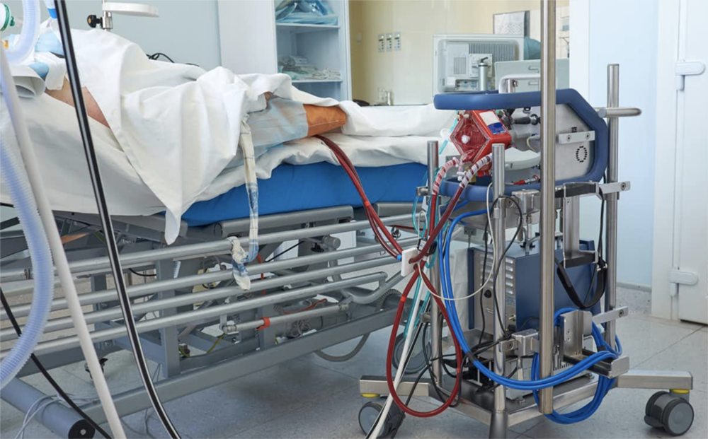 covid 19 phi cong nguoi anh tien trien kha quan co the cai ecmo