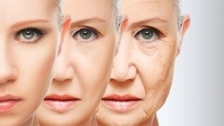 Bao nhiêu tuổi cần bổ sung collagen?