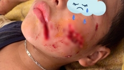 chu quan nghi no khong can dau be trai 7 tuoi bi cho can khau 70 mui
