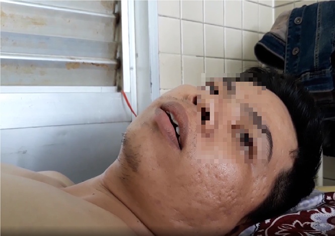 Bệnh nhân gãy đốt sống ngực, bệnh viện khoan nhầm cẳng chân benh nhan gay dot song nguc benh vien khoan nham cang chan