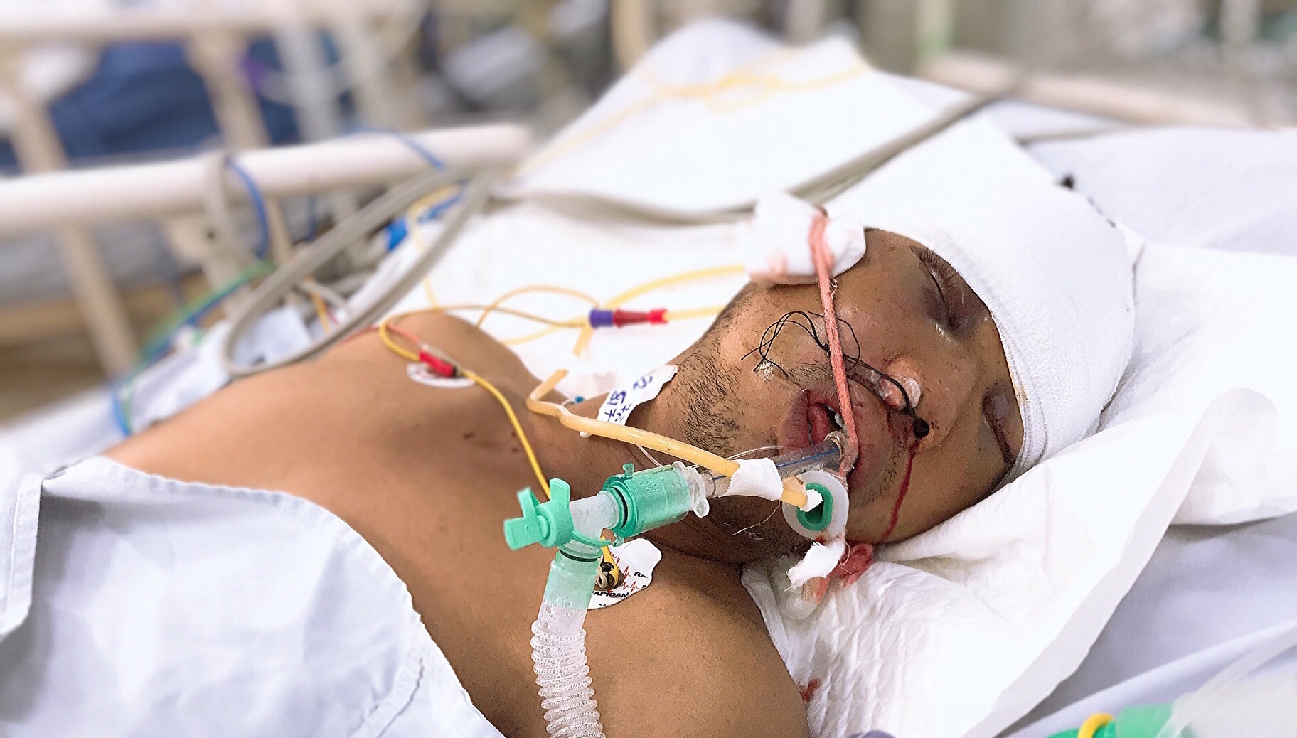 TP HCM: Tìm người thân cho bé trai 3 tuổi và bố bị tai nạn giao thông nghiêm trọng tp hcm tim nguoi than cho be trai 3 tuoi va bo bi tai nan giao thong nghiem trong