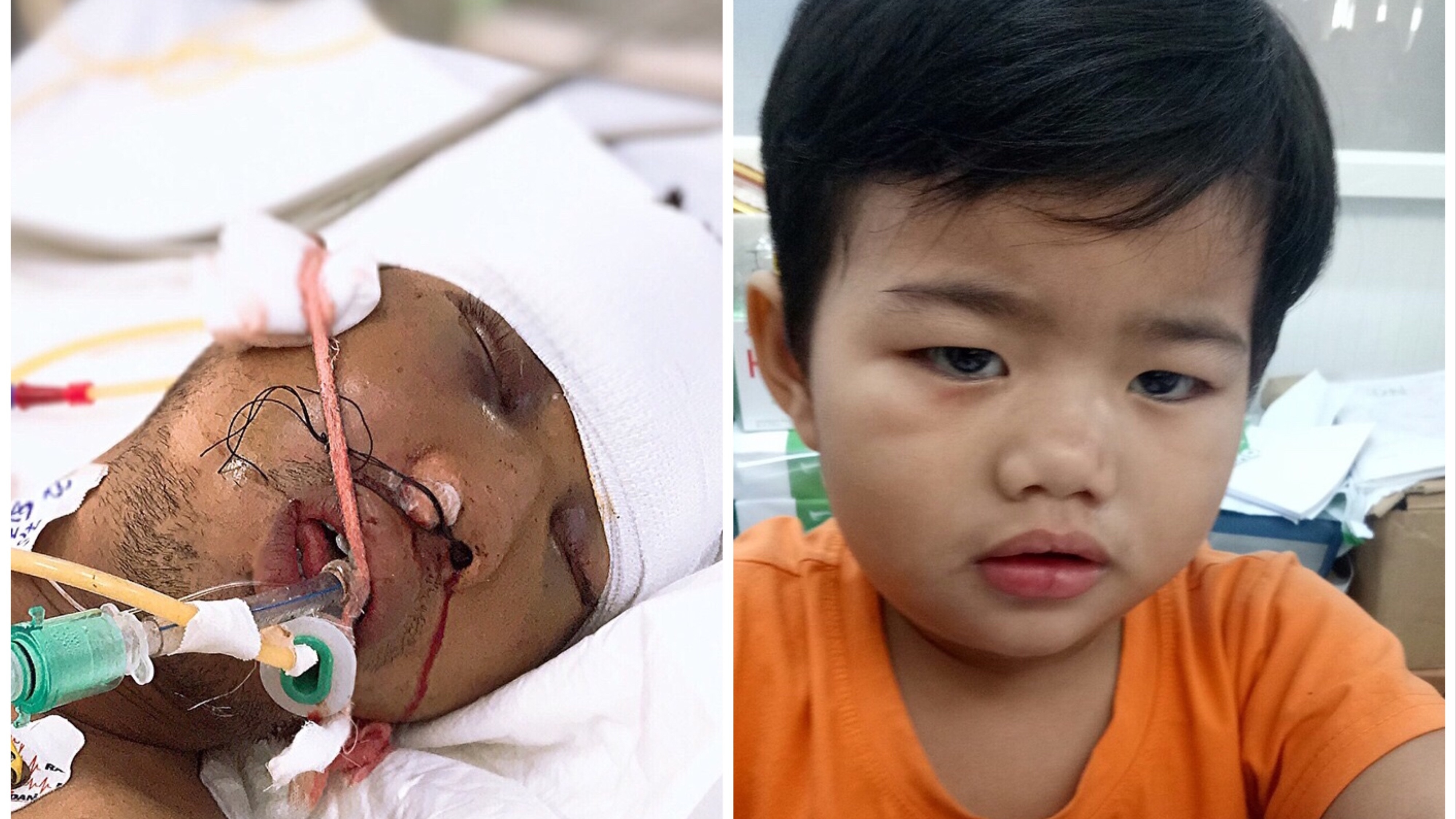 TP HCM: Tìm người thân cho bé trai 3 tuổi và bố bị tai nạn giao thông nghiêm trọng