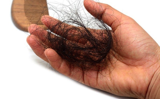 Xét nghiệm ADN 4 người đàn ông mới tìm ra bố ruột của con xet nghiem adn 4 nguoi dan ong moi tim ra bo ruot cua con