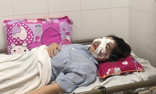 tiem mo lam dep co gai ha noi phai rach mat de nan mu
