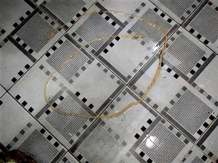 Người đàn ông xổ ra sán xơ mít dài 2m nguoi dan ong xo ra san xo mit dai 2m