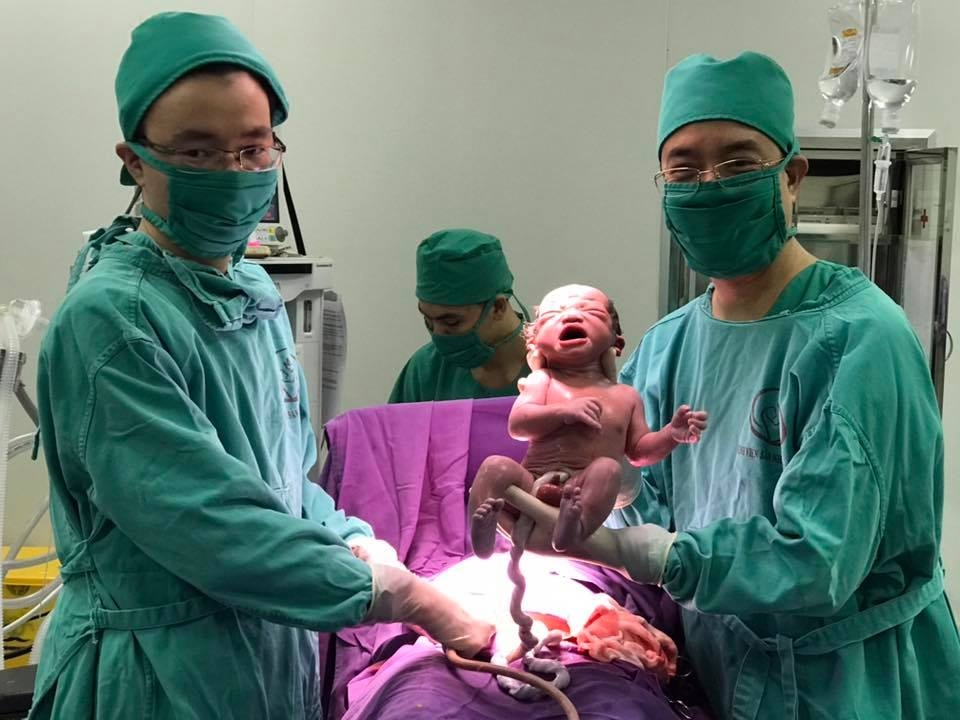 Cận cảnh cặp sinh đôi chào đời còn nguyên trong bọc ối can canh cap sinh doi chao doi con nguyen trong boc oi