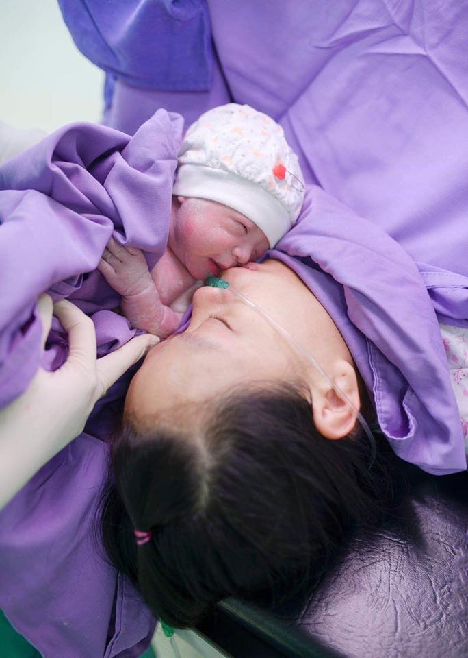 Cận cảnh cặp sinh đôi chào đời còn nguyên trong bọc ối can canh cap sinh doi chao doi con nguyen trong boc oi