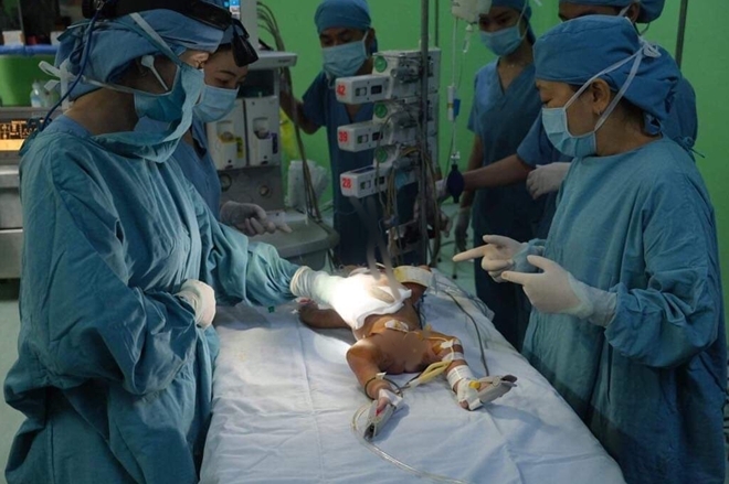 Cận cảnh ca phẫu thuật tách rời cặp sinh đôi dính liền bụng hơn 1 tháng tuổi can canh ca phau thuat tach roi cap sinh doi dinh lien bung hon 1 thang tuoi
