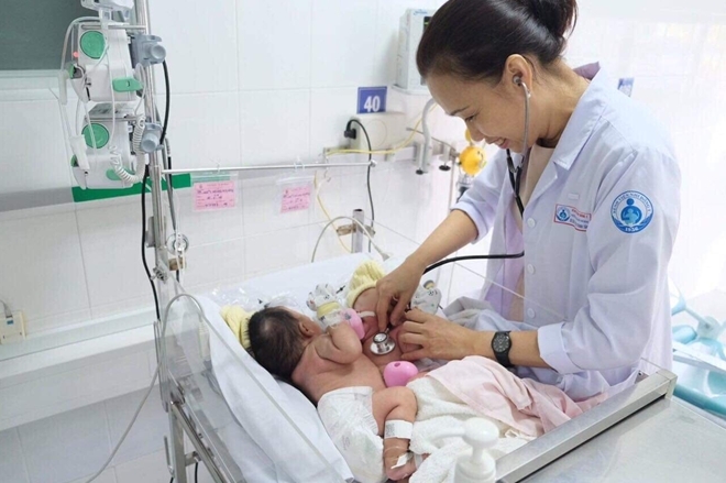 Cận cảnh ca phẫu thuật tách rời cặp sinh đôi dính liền bụng hơn 1 tháng tuổi can canh ca phau thuat tach roi cap sinh doi dinh lien bung hon 1 thang tuoi