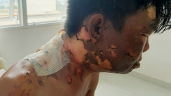 tin moi vu chong hat nuoc soi vao vo o do luong nghe an