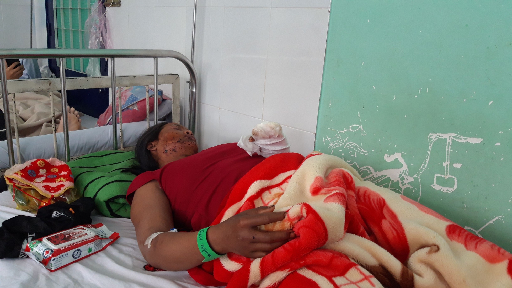Kê đạn pháo cũ làm kiềng bếp, nổ kinh hoàng khiến 9 người bị thương ở Kon Tum no dau dan phao khien 9 nguoi bi thuong be gai 22 thang nguy kich