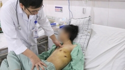 singapore xuat hien ca dau tien bi viem phoi do virus la
